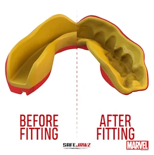 Protège dents SAFEJAWZ  Marvel Iron Man Senior