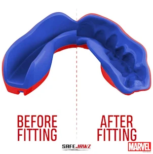 Protège dents SAFEJAWZ  Marvel Spider Man Senior